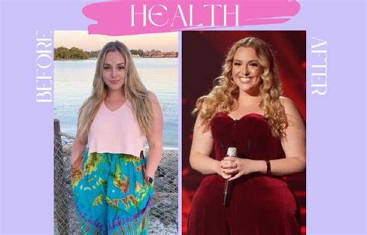 American Idol Grace Kinstler Had A Plastic Surgery: Know Her Weight Loss Journey