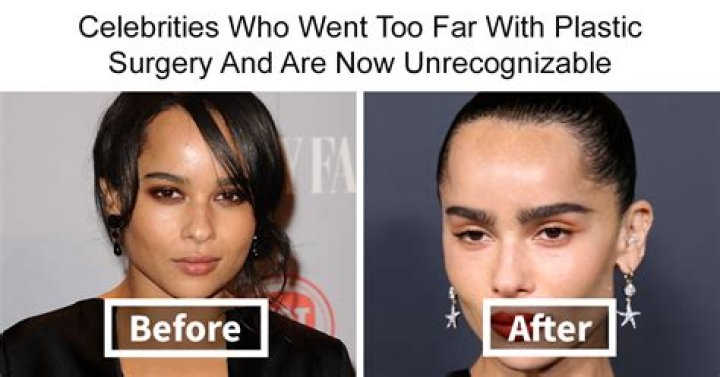 Marijana Veljovic: Does She Have Botox? Photo Of Plastic Surgery Before And After